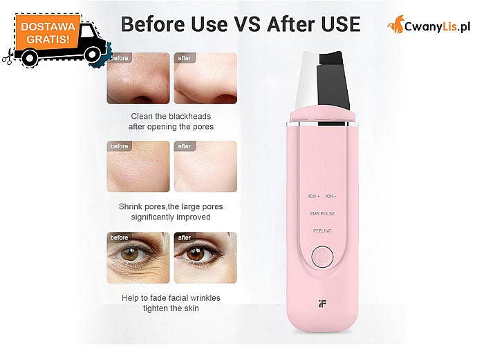 Ultradźwiękowe oczyszczanie twarzy! Urządzenie Xiaomi z funkcją peelingu, oczyszczania i masażu!