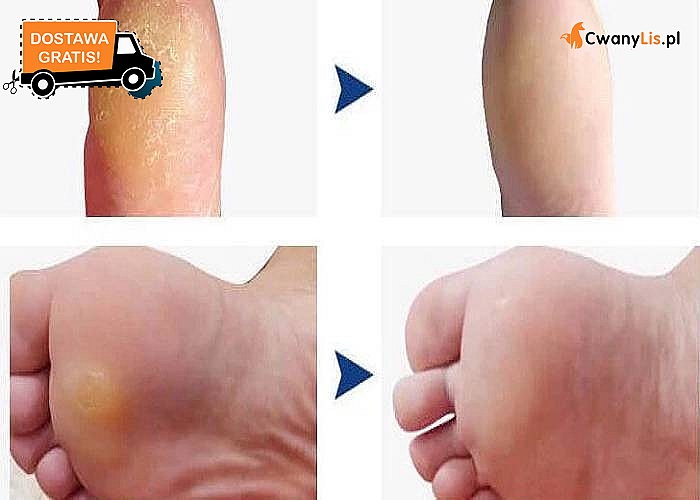 Wyjątkowo skuteczny płyn, który w łagodny sposób zmiękczy stwardniałą skórę na stopach.